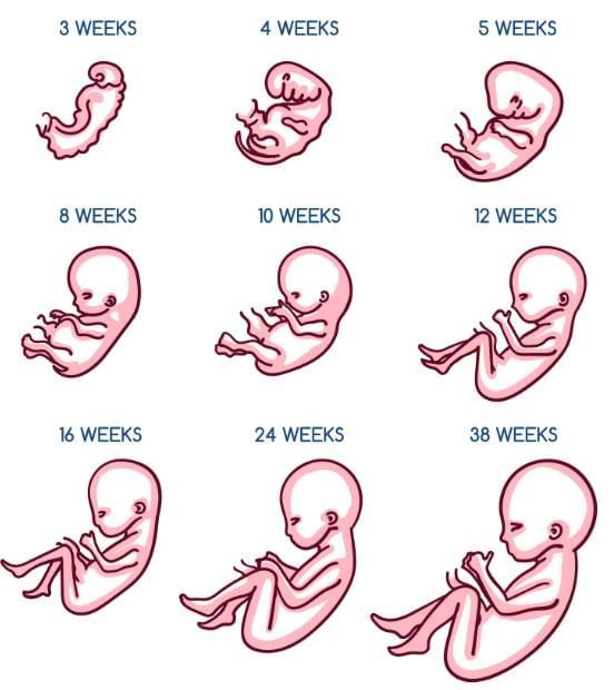 Infanticide Foeticides and Child Abuse Chapter Notes | Forensic Medicine and Toxicology (FMT) - NEET PG