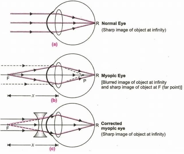 Lenses Chapter Notes | Physics for EmSAT Achieve