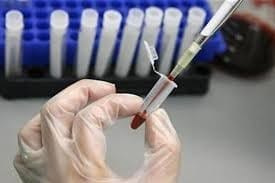 Nucleic Acid Test (NAT) for Blood Transfusion
