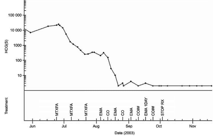The Management of Placental site Trophoblast Disease