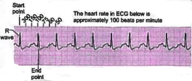Cardiology Chapter Notes | Medicine - NEET PG